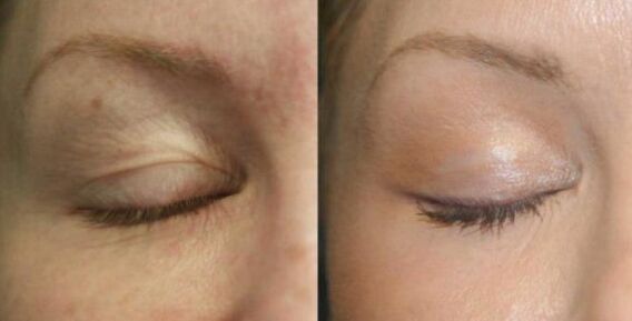 Take care of areas near the eyes