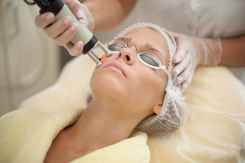 Skin laser renewal