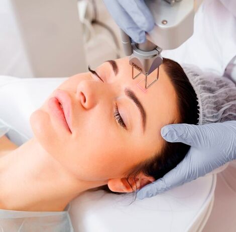 Human laser renewal