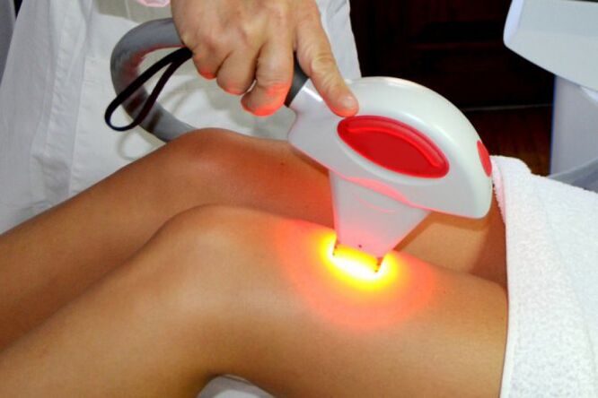 Remove laser hair removal