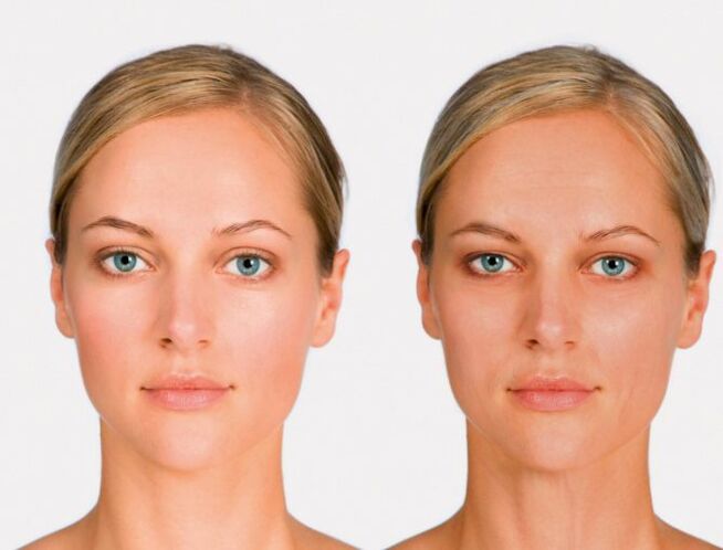 face after and before renewal
