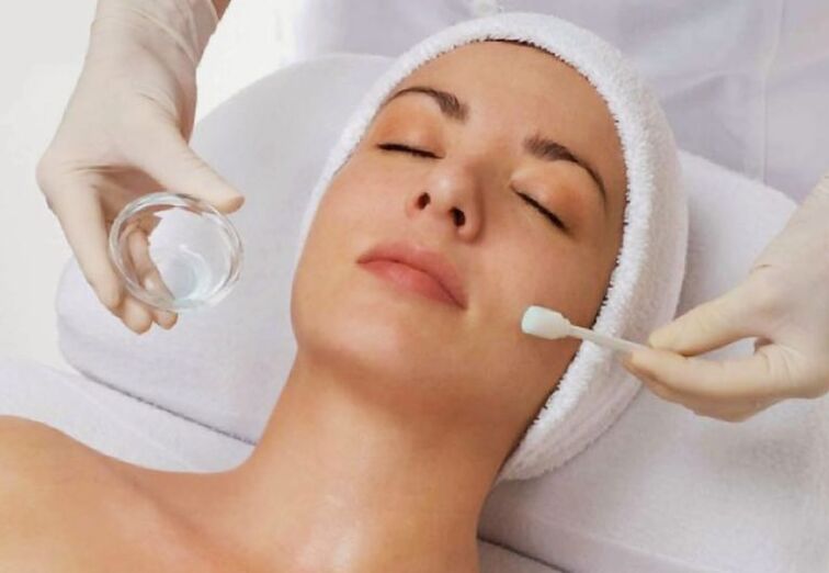 chemical peeling for skin rejuvenation